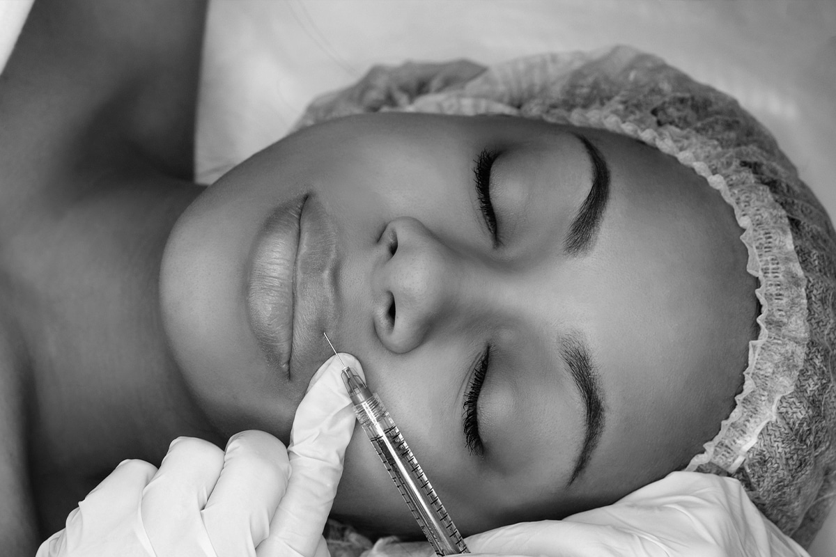 Woman getting botox in her upper lip, black and white photo